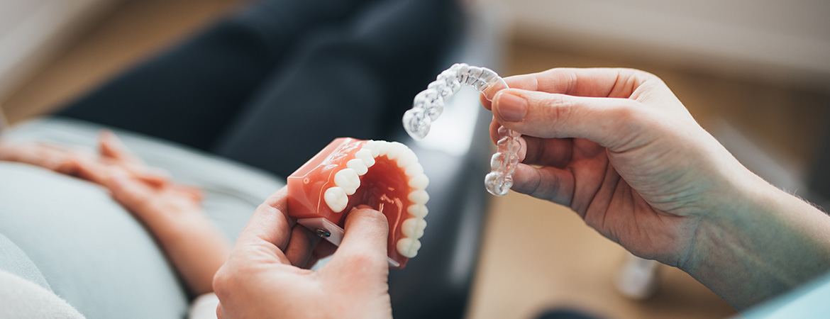 Zahnstellung sichern: Retainer in Gießen nach Zahnkorrektur